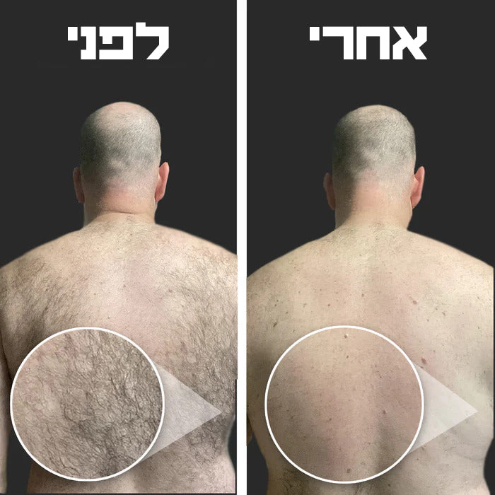 מכשיר גילוח גב וגוף המקורי לגבר®